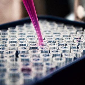 HPLC 基礎(chǔ)知識(shí)——所有關(guān)于液相色譜的基礎(chǔ)知識(shí)